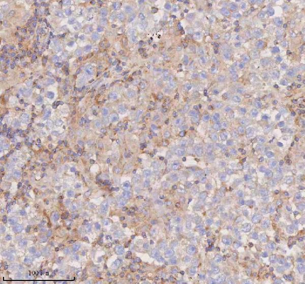a08215 1 scamp3 primary antibodies ihc testing 13