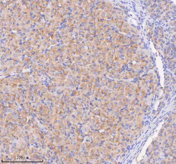a08215 1 scamp3 primary antibodies ihc testing 15