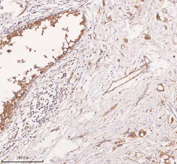 a08215 1 scamp3 primary antibodies ihc testing 4