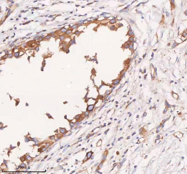 a08215 1 scamp3 primary antibodies ihc testing 5