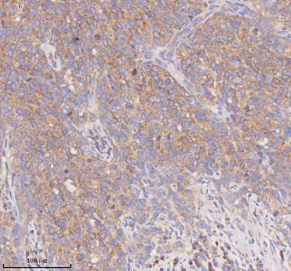 a08215 1 scamp3 primary antibodies ihc testing 7