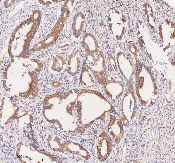 a08215 1 scamp3 primary antibodies ihc testing 8