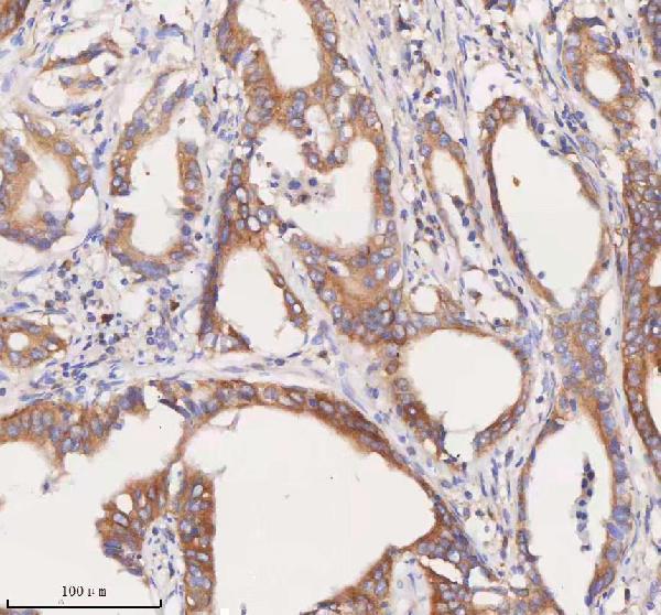 a08215 1 scamp3 primary antibodies ihc testing 9