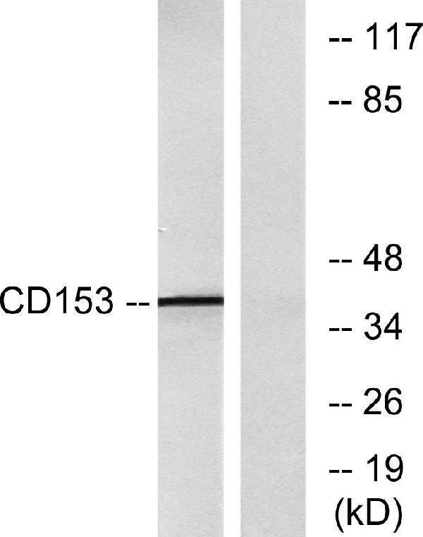 Western blot analysis of lysates from RAW264