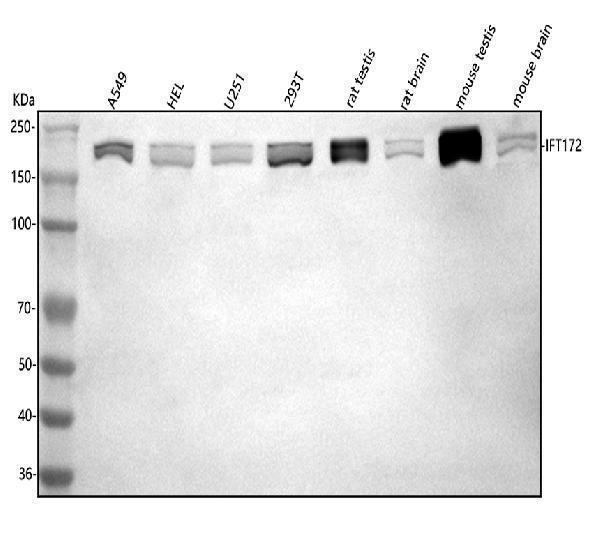  Western blot analysis of IFT172 using anti-IFT172 antibody (A08217-1)