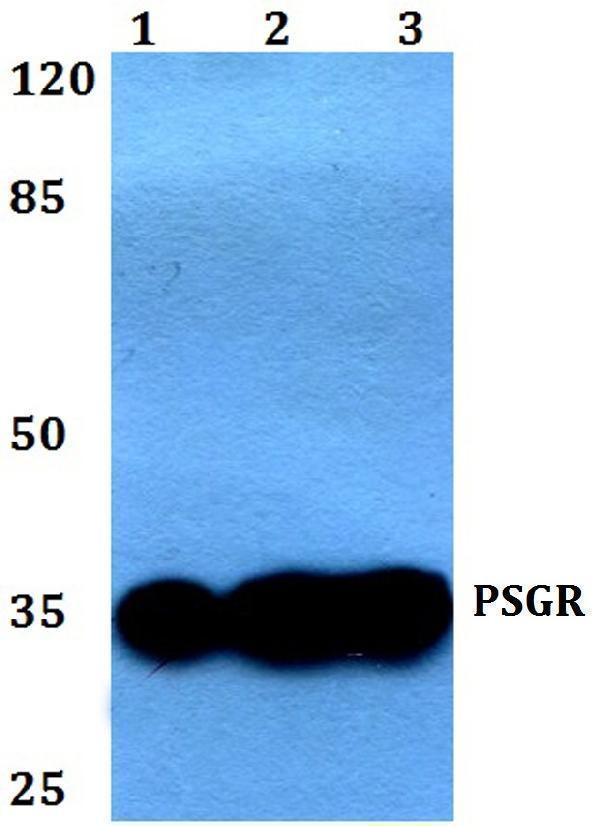 a08220 or51e2 primary antiboties wb testing 1