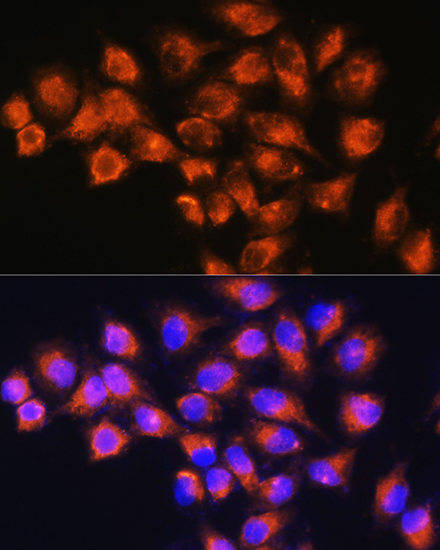 Immunofluorescence analysis of HeLa cells using NPB Rabbit pAb  at dilution of 1:100