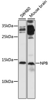 Western blot analysis of extracts of various cell lines, using NPB antibody  at 1:1000 dilution