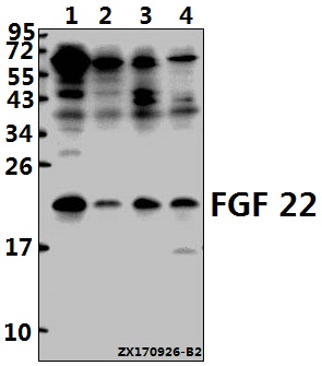 Western blot (WB) analysis of FGF 22 (A96) pAb at 1:500 dilution
Lane1:HEK293T whole cell lysate(40ug)
Lane2:MCF-7 whole cell lysate(40ug)
Lane3:C6 whole cell lysate(40ug)
Lane4:BV2 whole cell lysate(40ug)
