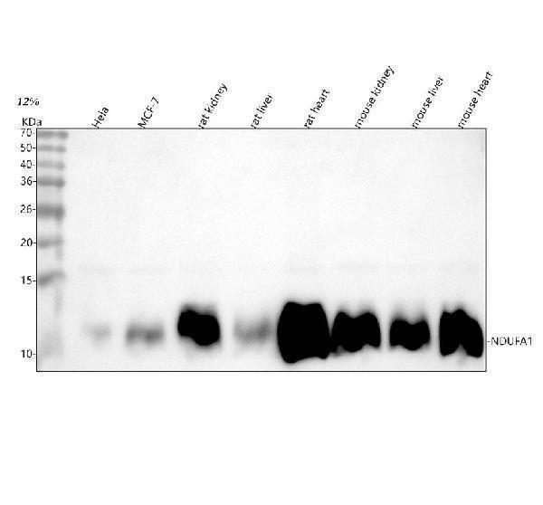  Western blot analysis of NDUFA1 using anti-NDUFA1 antibody (A08224)