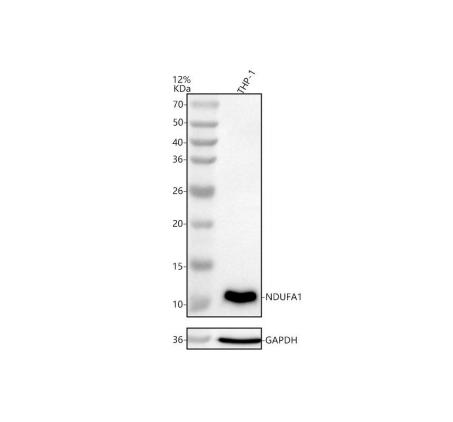  Western blot analysis of NDUFA1 using anti-NDUFA1 antibody (A08224)