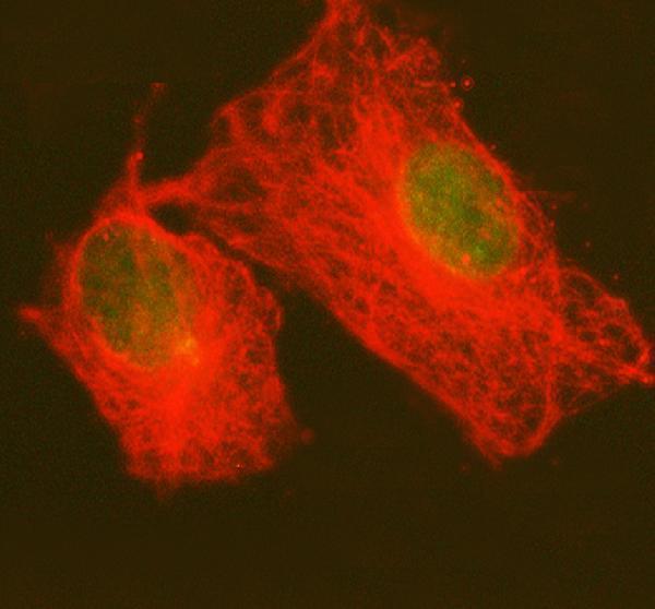 a08225 2 prpf4 primary antibodies if testing 6