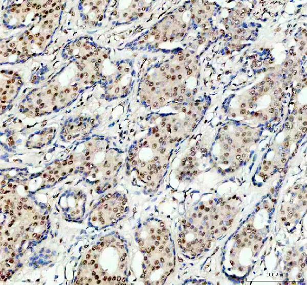 a08225 2 prpf4 primary antibodies ihc testing 2