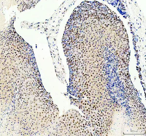 a08225 2 prpf4 primary antibodies ihc testing 3