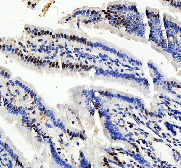 a08225 2 prpf4 primary antibodies ihc testing 4