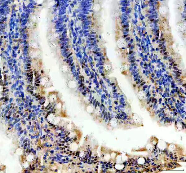 a08225 2 prpf4 primary antibodies ihc testing 5