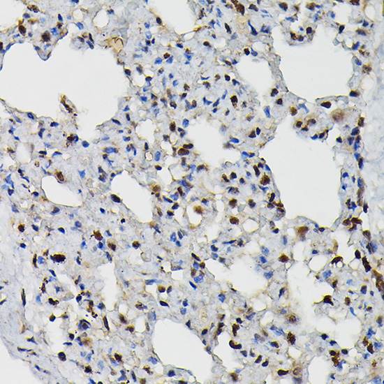 a08225 prpf4 primary antiboties ihc testing 2