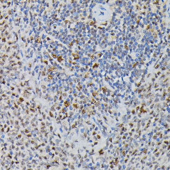 a08225 prpf4 primary antiboties ihc testing 3