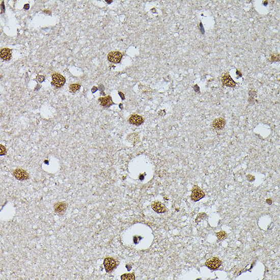 a08225 prpf4 primary antiboties ihc testing 4