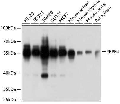 a08225 prpf4 primary antiboties wb testing 1