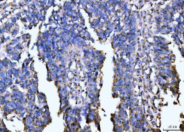  IHC analysis of Giantin/GOLGB1 using anti-Giantin/GOLGB1 antibody (A08226-1)