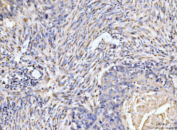  IHC analysis of Giantin/GOLGB1 using anti-Giantin/GOLGB1 antibody (A08226-1)