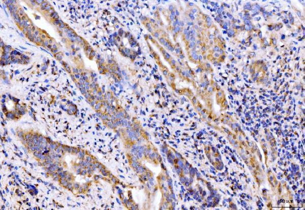 a08226 1 golgb1 primary antibodies ihc testing 4