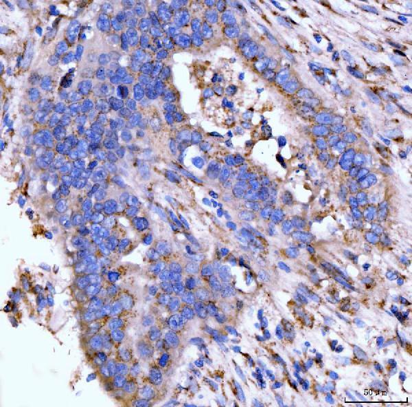 a08226 1 golgb1 primary antibodies ihc testing 6