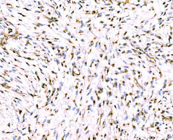 a08226 1 golgb1 primary antibodies ihc testing 7
