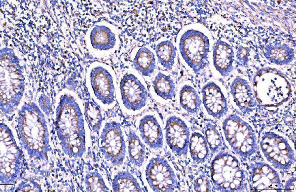 a08226 1 golgb1 primary antibodies ihc testing 8