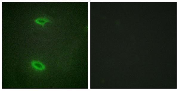 a08230 1 dlgap1 primary antibodies if testing 1