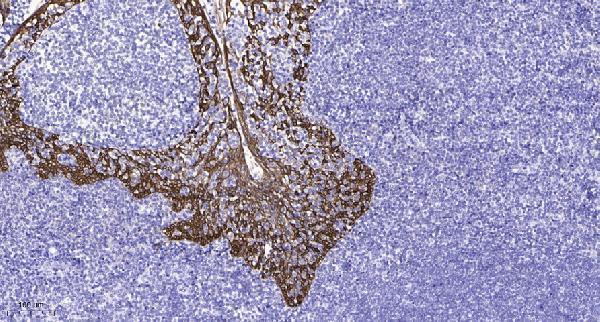 a08230 1 dlgap1 primary antibodies ihc testing 4