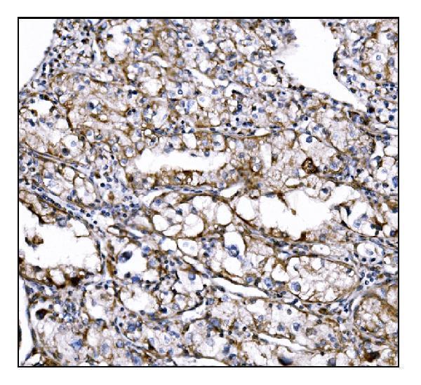  IHC analysis of DLGAP1 using anti-DLGAP1 antibody (A08230-2)