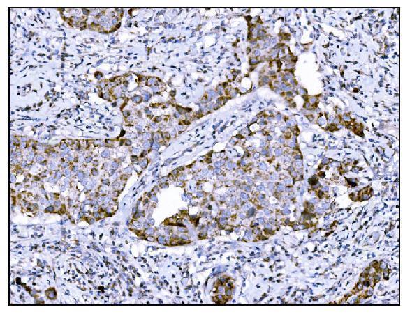  IHC analysis of DLGAP1 using anti-DLGAP1 antibody (A08230-2)