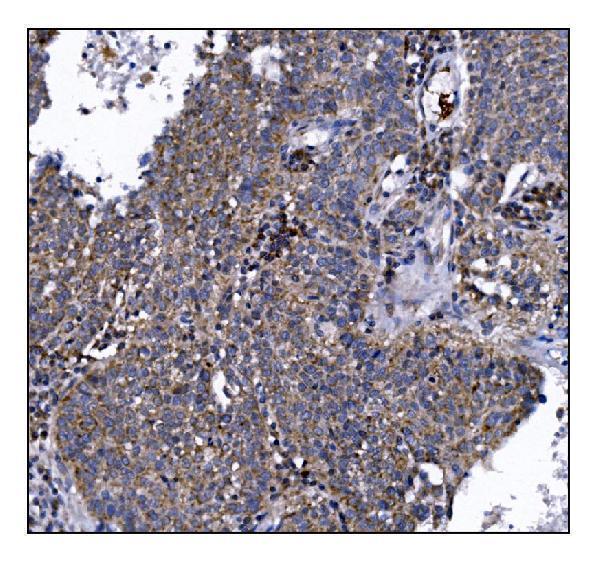a08230 2 dlgap1 primary antibodies ihc testing 5