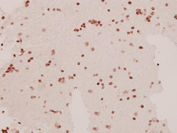 a08230 dlgap1 primary antiboties ihc testing 2
