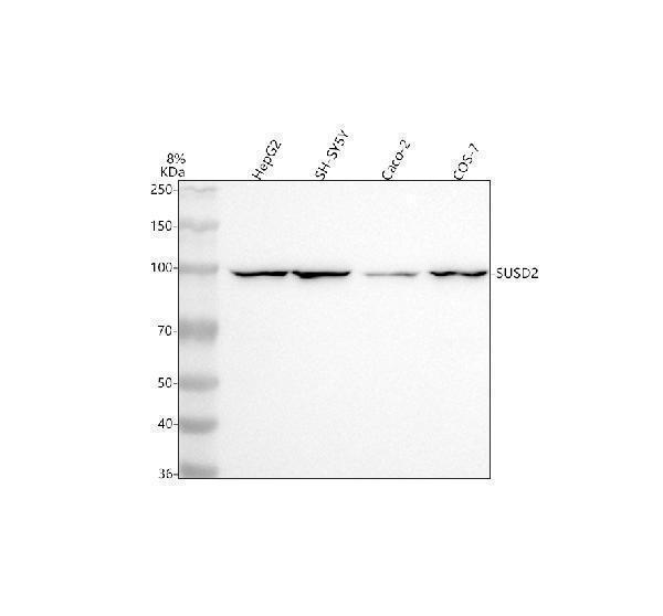 a08232 susd2 primary antibodies wb testing 1