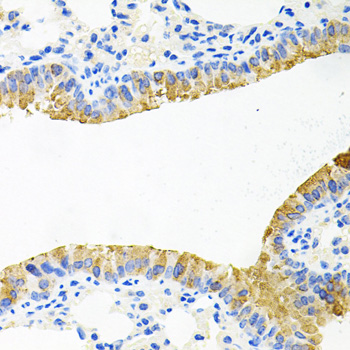 a08236 tob2 primary antiboties ihc testing 3