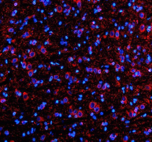 a08238 1 shd primary antibodies if testing 2