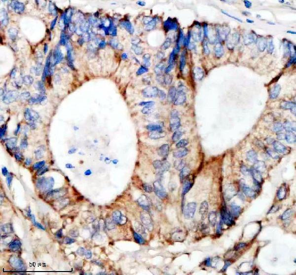 IHC analysis of SHD using anti-SHD antibody (A08238-1)