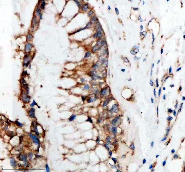 IHC analysis of SHD using anti-SHD antibody (A08238-1)