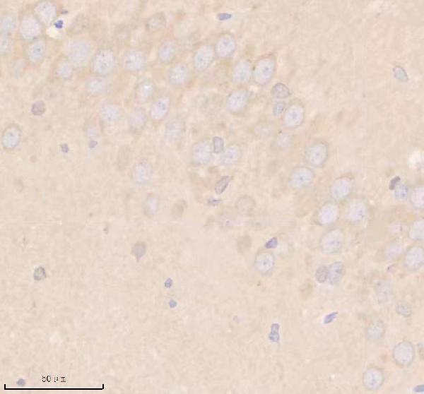 a08238 1 shd primary antibodies ihc testing 6