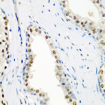 a08240 1 sf3b3 primary antiboties ihc testing 2
