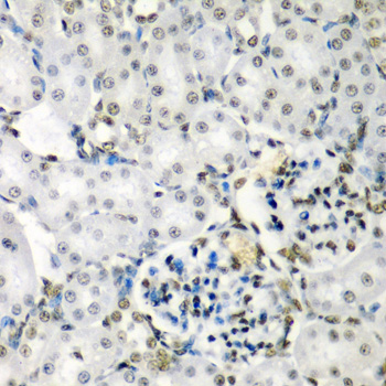 a08240 1 sf3b3 primary antiboties ihc testing 3