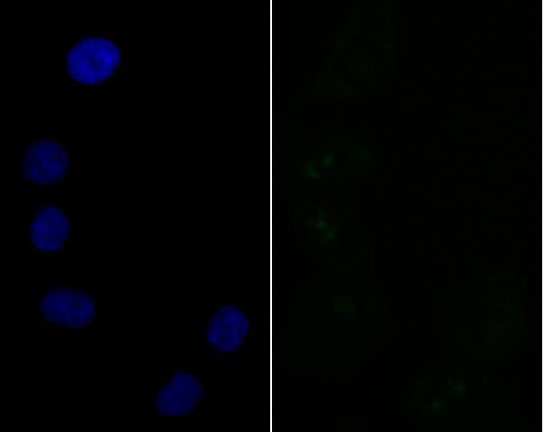 a08240 2 sf3b3 primary antiboties icc testing 2