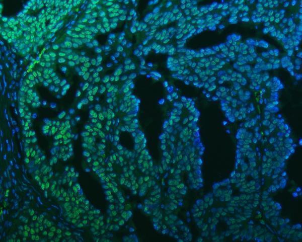 a08240 3 sf3b3 primary antibodies if testing 17