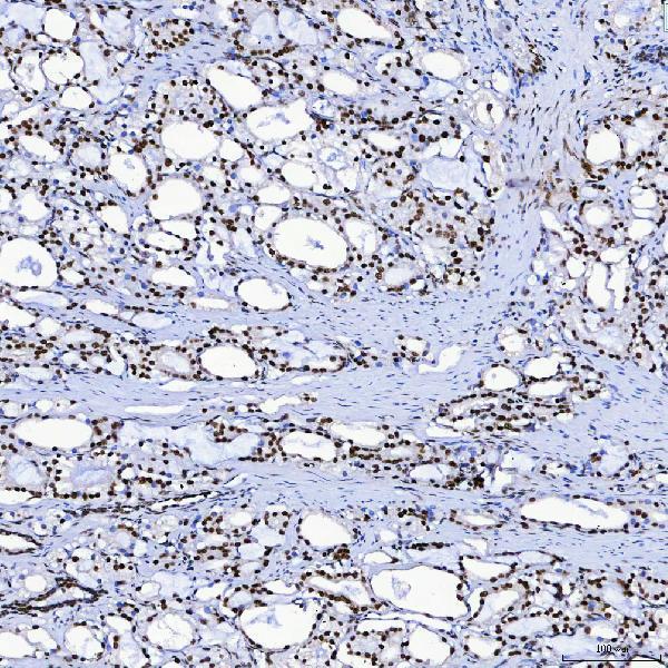 a08240 3 sf3b3 primary antibodies ihc testing 10
