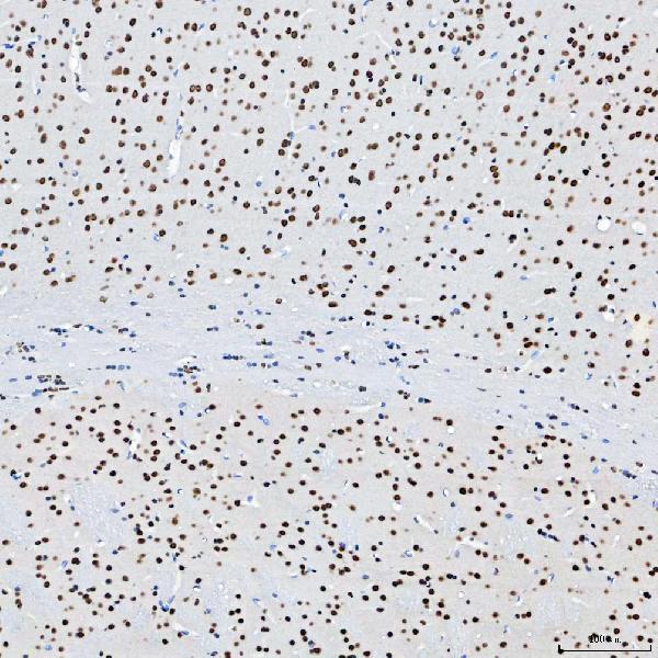 a08240 3 sf3b3 primary antibodies ihc testing 11