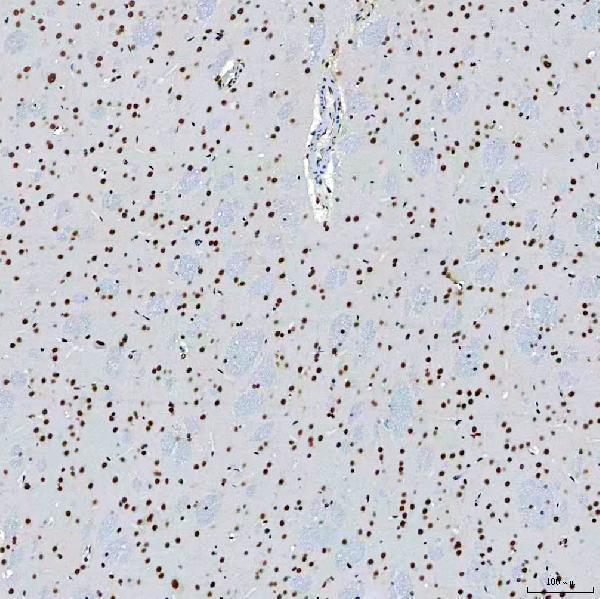 a08240 3 sf3b3 primary antibodies ihc testing 13