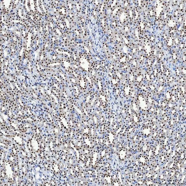a08240 3 sf3b3 primary antibodies ihc testing 14